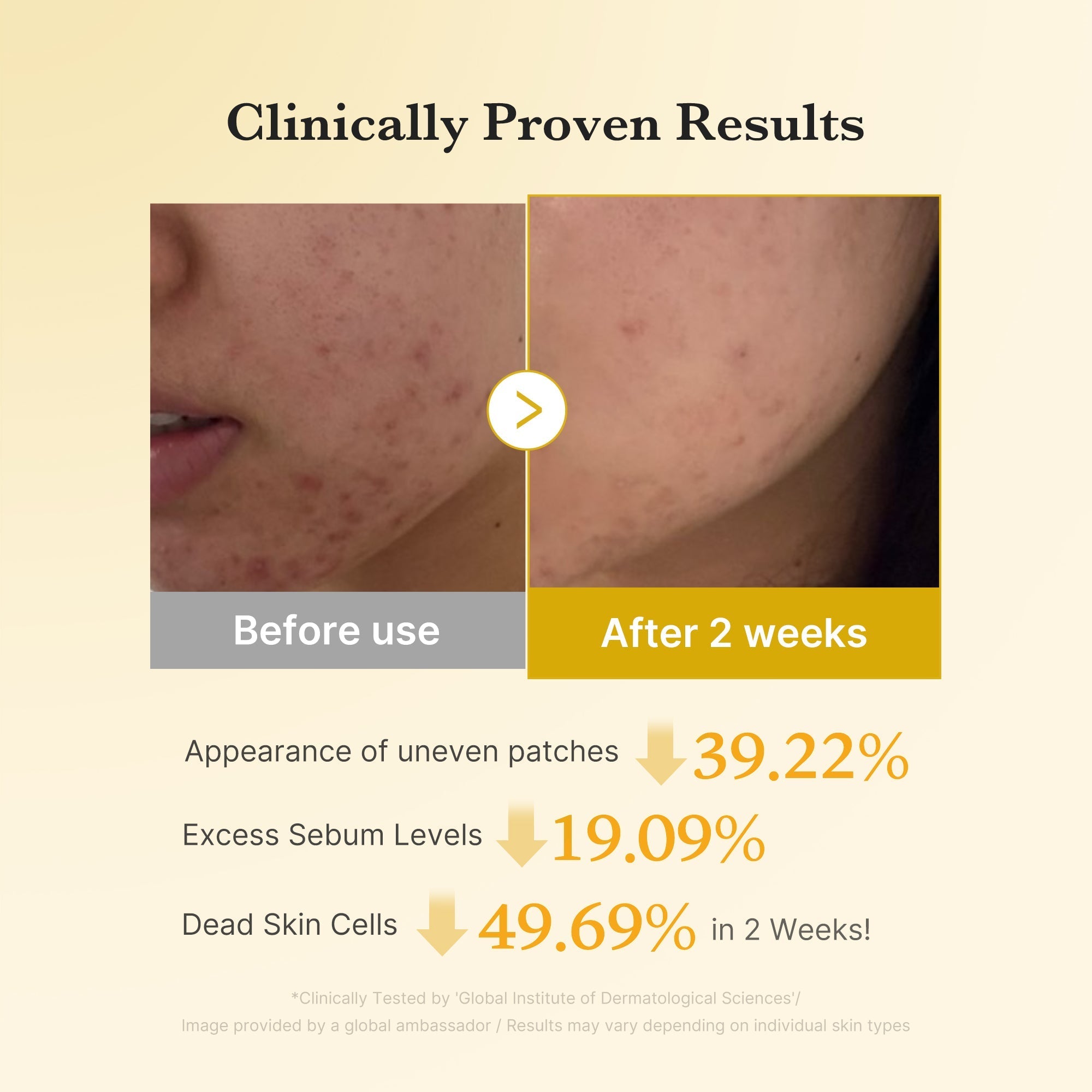 [GIFT] Kojic Acid Tumeric Toner Pad
